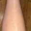 Philips Lumea IPL 9900 - been na 3 maanden behandeling
