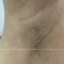Philips Lumea IPL 9900 app met SkinAI