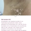 Philips Lumea IPL 9900 app met SkinAI